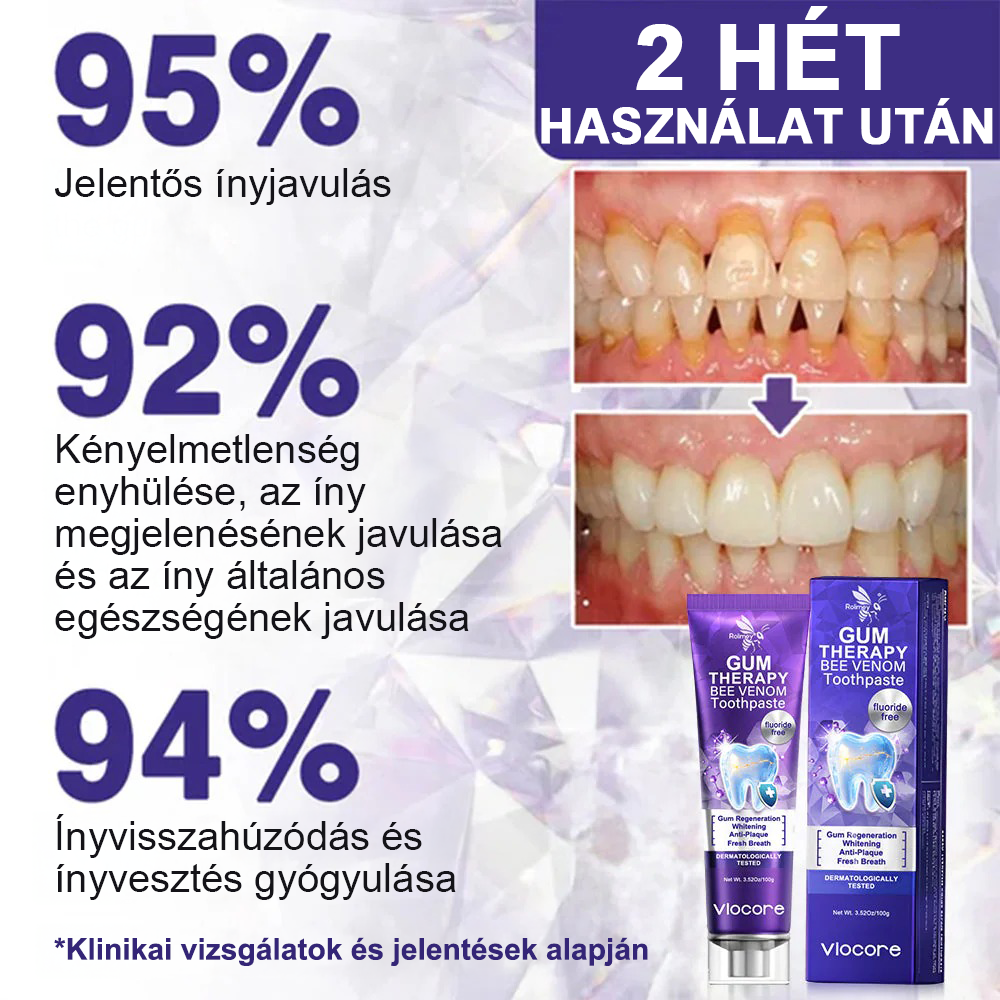 🌟Οδοντόκρεμα Rolimey® VioCore για την οδοντιατρική θεραπεία με δηλητήριο μέλισσας