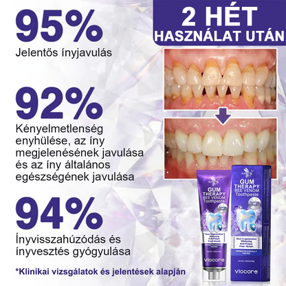 🌟Οδοντόκρεμα Rolimey® VioCore για την οδοντιατρική θεραπεία με δηλητήριο μέλισσας